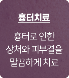 흉터치료, 엑스카,