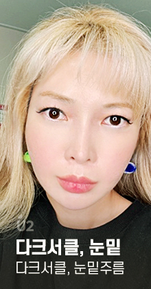 다크서클, 눈밑주름 개선