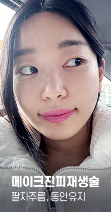 팔자주름 Real Before After! #shorts