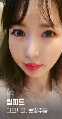 림피드, 다크서클, 눈밑주름, 눈밑지방, 눈밑꺼짐 #shorts