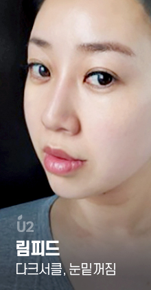 림피드, 다크서클, 눈밑주름, 눈밑지방, 눈밑꺼짐 #shorts