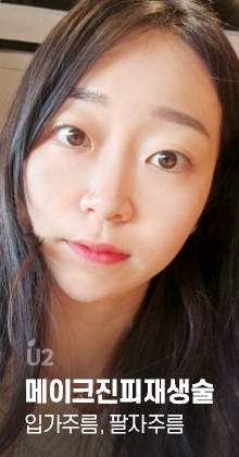 팔자주름 Real Before After! #shorts