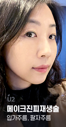 팔자주름 Real Before After! #shorts