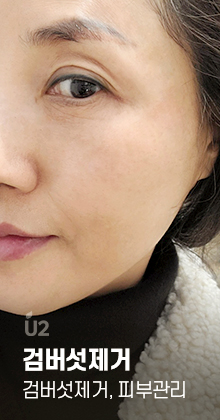 자연스러운 눈썹문신 before & after #shorts